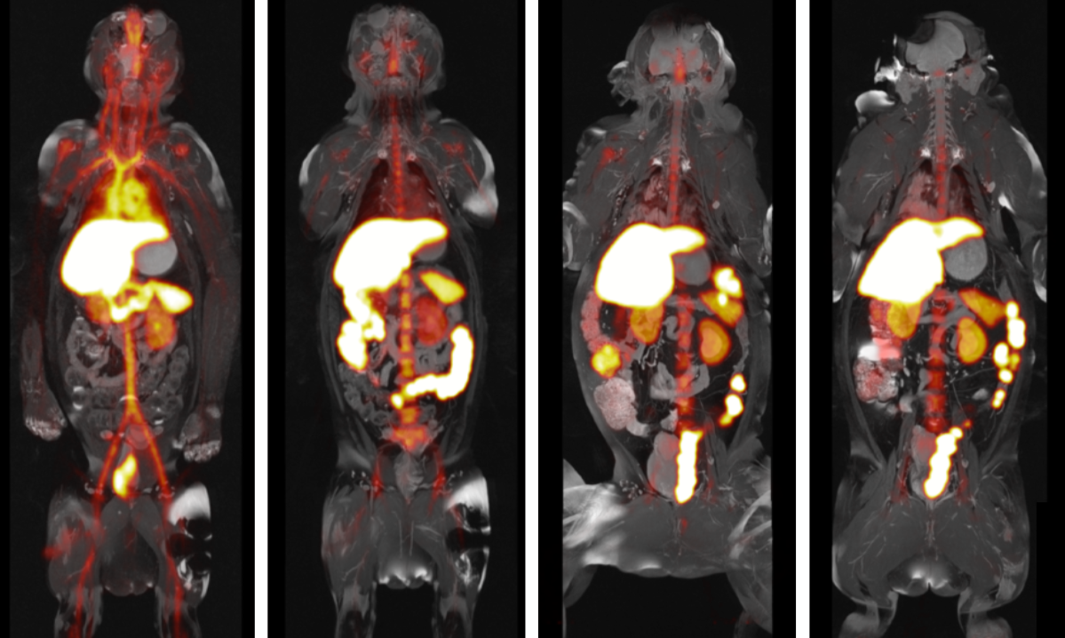 Forging nanoparticles to treat cardiovascular disease
