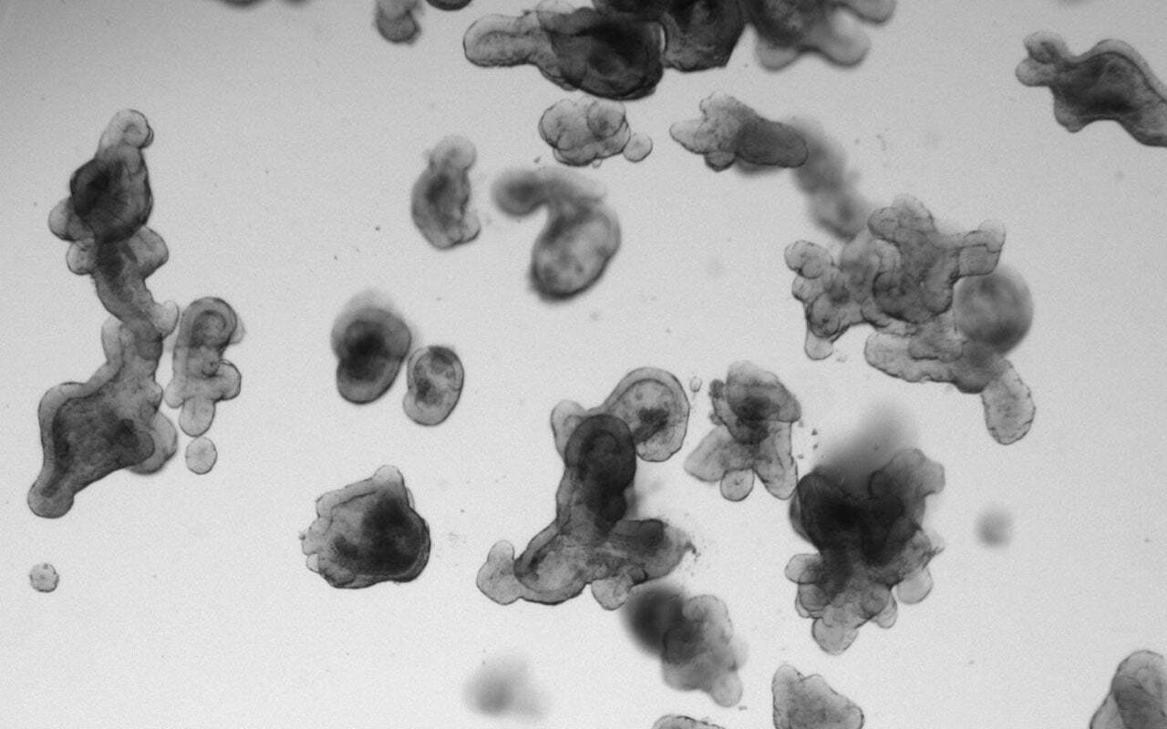 From organoids to patients: The translational journey behind the RASTRIC trial