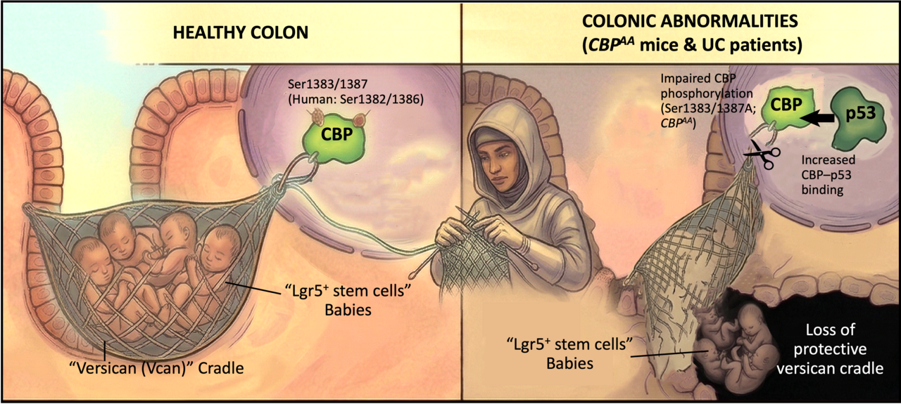 The Molecular Aegis: Defending the Gut Against IBD