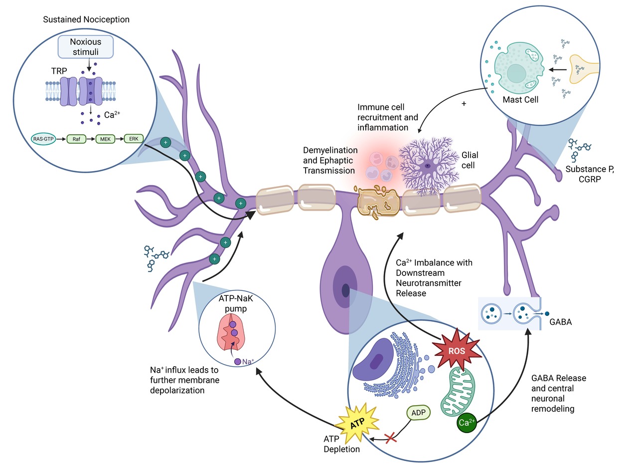 Behind the Paper: Chronic pancreatitis pain is not one disease; and that matters
