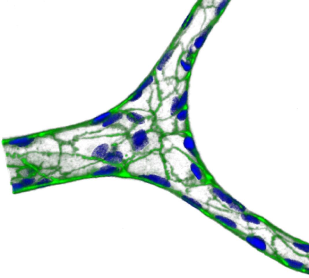 Building physiologically-relevant microvasculature-on-chips
